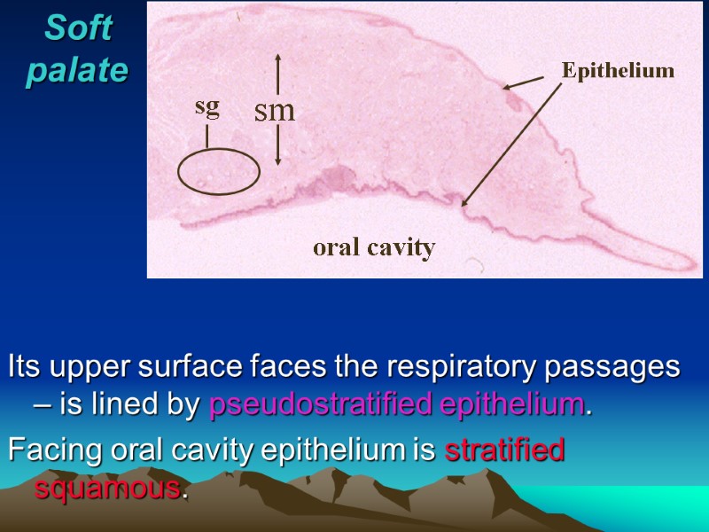 Soft palate sm Epithelium sg oral cavity  Its upper surface faces the respiratory